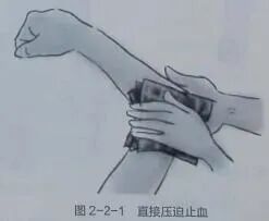 医用绷带为什么能止血【金豆培训】为外伤出血的患者包扎止血_https://www.jmylbn.com_新闻资讯_第2张