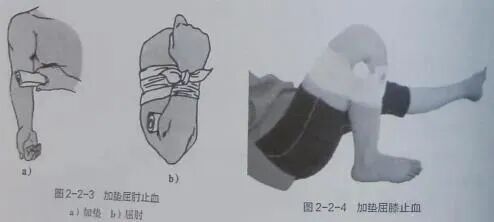 医用绷带为什么能止血【金豆培训】为外伤出血的患者包扎止血_https://www.jmylbn.com_新闻资讯_第4张