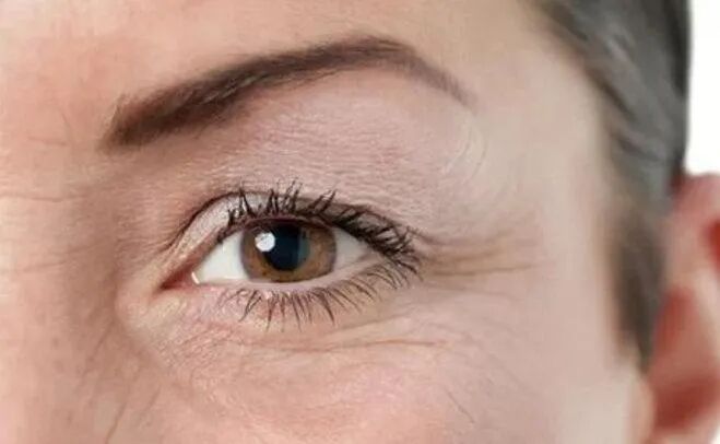 「静态皱纹」,是皮肤老化的表现,眼霜对于这种皱纹的改善,其实相当