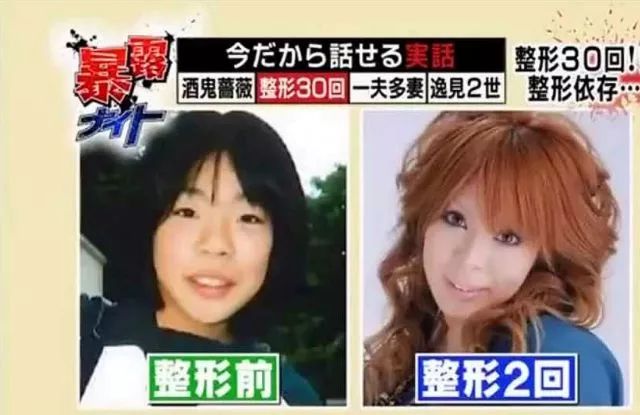 整容超过100 次 日本女星为成为法国洋娃娃 狂砸2 亿日圆 潮货酱 微信公众号文章阅读 Wemp