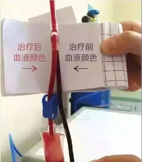 臭氧治疗什么病臭氧大自血针对各种疾病的治疗原理_https://www.jmylbn.com_新闻资讯_第6张