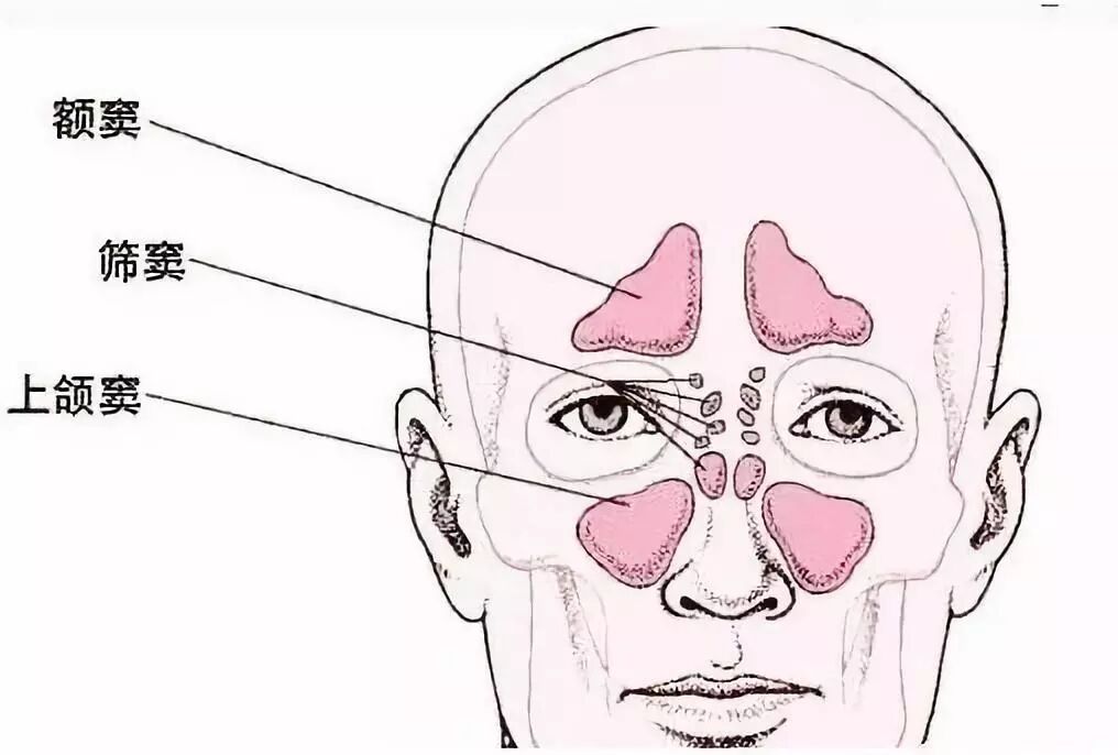 鼻窦炎不是小病，拖延治疗，当心“惹上”大麻烦