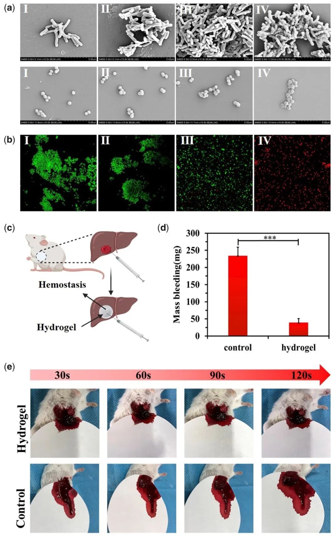 医用抗菌水凝胶怎么用RB 速递 ｜ 四川大学魏清荣副研究员团队：基于胶原蛋白的可注射自修复多功能水凝胶在感染性伤口再生修复中的应用_https://www.jmylbn.com_新闻资讯_第5张