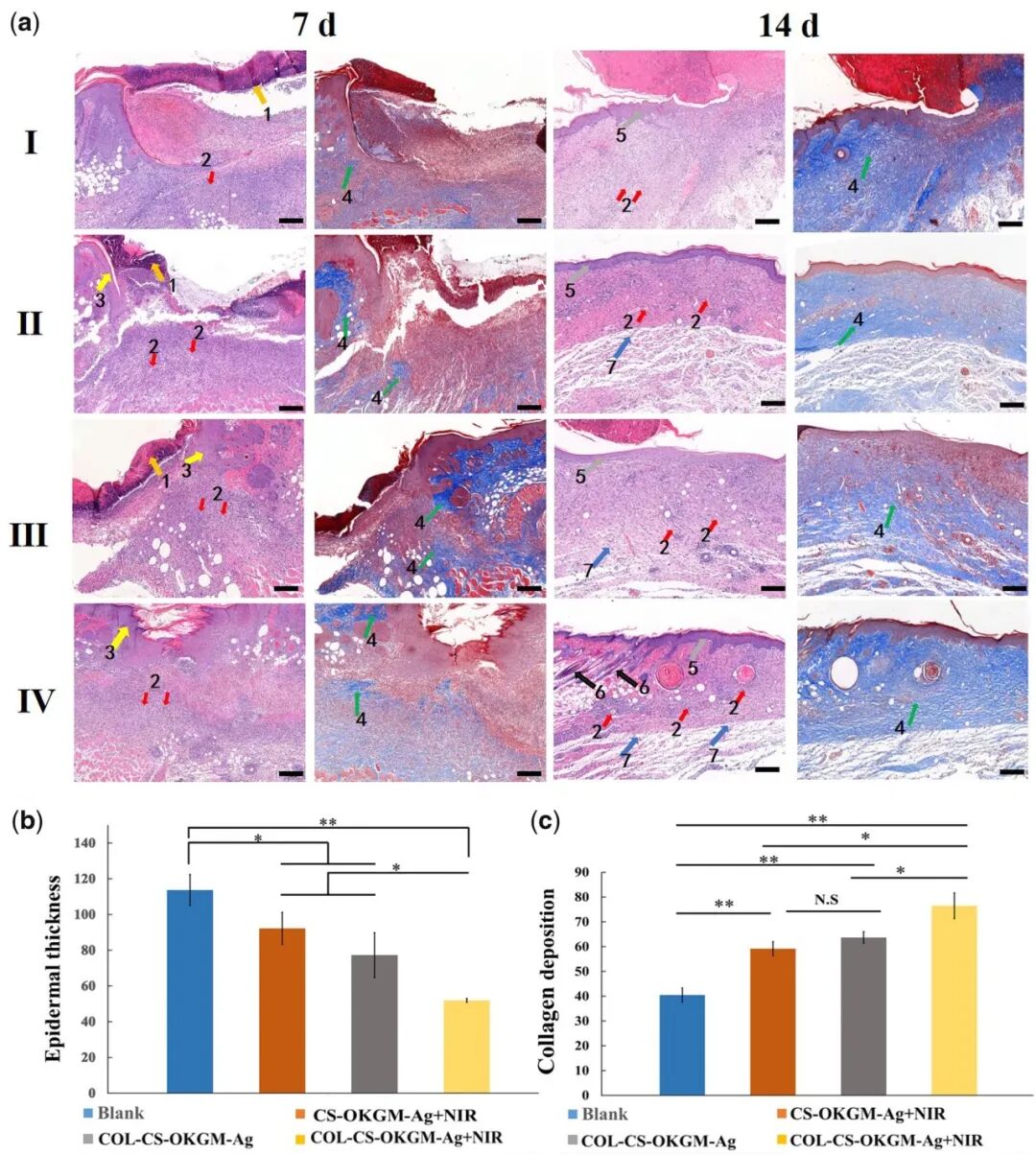 医用抗菌水凝胶怎么用RB 速递 ｜ 四川大学魏清荣副研究员团队：基于胶原蛋白的可注射自修复多功能水凝胶在感染性伤口再生修复中的应用_https://www.jmylbn.com_新闻资讯_第7张