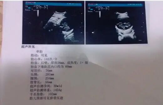 眼科ab超单怎么看B超单能看男女？超简单的方法教你看懂B超单的秘密！_https://www.jmylbn.com_新闻资讯_第9张