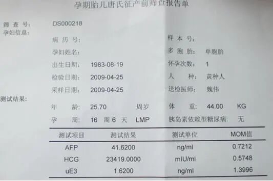 眼科ab超单怎么看B超单能看男女？超简单的方法教你看懂B超单的秘密！_https://www.jmylbn.com_新闻资讯_第11张