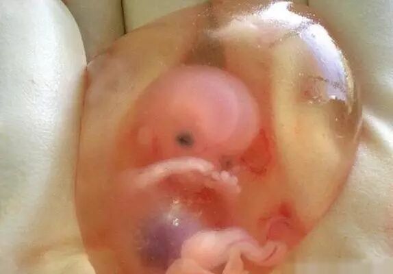 怎么用手抓到子宫21周的胎儿从子宫伸出“希望之手”抓住医生，生命的奇迹！_https://www.jmylbn.com_新闻资讯_第4张