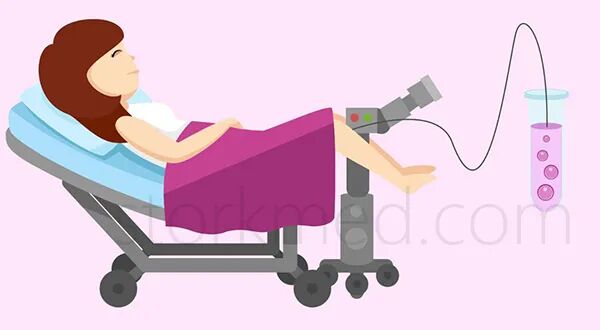 取卵针什么样的【干货】取卵针取卵过程图，做试管婴儿记得收藏！_https://www.jmylbn.com_新闻资讯_第1张