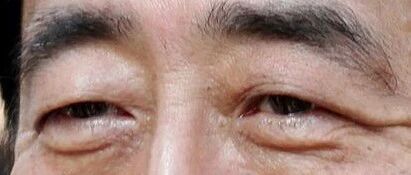 安倍晋三之死
