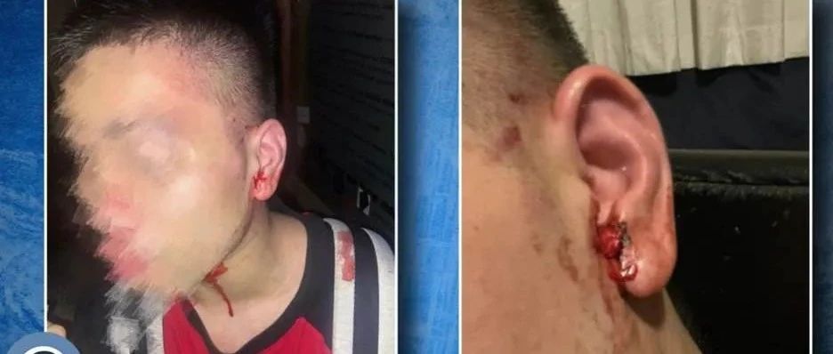 怒炸！中国留学生遭围殴，40秒暴打，头破血流！警方逮捕4人…