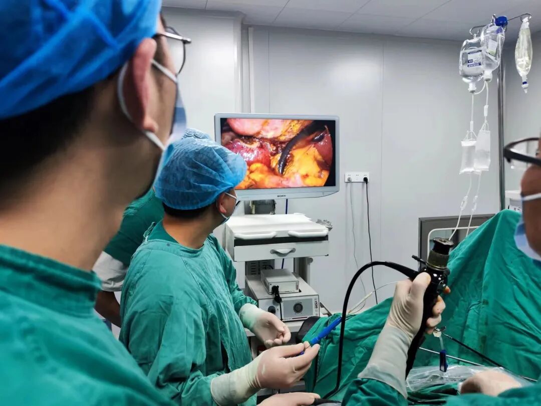 狼牌胆道镜怎么装新技术丨我院成功开展腹腔镜下微创胆道镜手术（LCBDE），快来了解一下！_https://www.jmylbn.com_新闻资讯_第2张