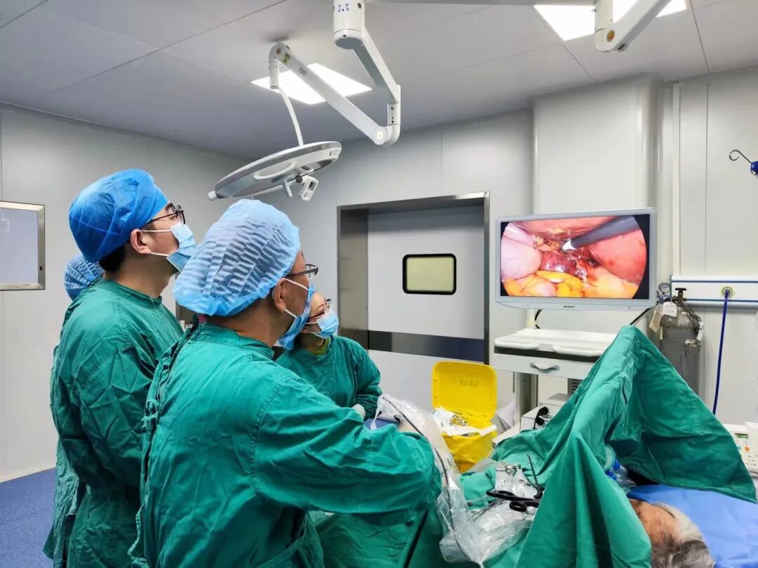 狼牌胆道镜怎么装新技术丨我院成功开展腹腔镜下微创胆道镜手术（LCBDE），快来了解一下！_https://www.jmylbn.com_新闻资讯_第4张