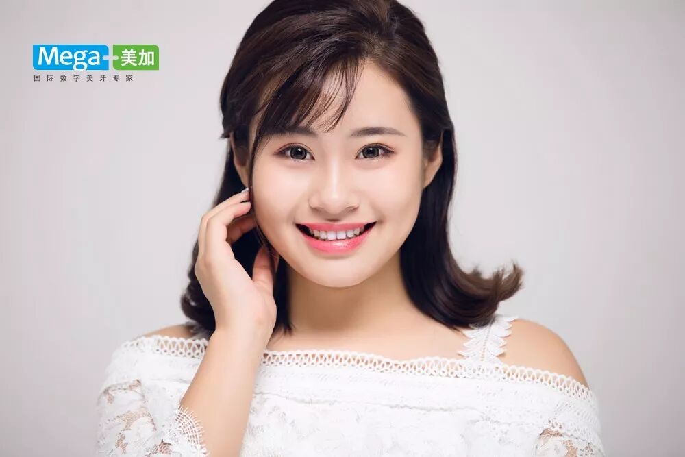 矫正+贴面，适合大部分的美牙案例