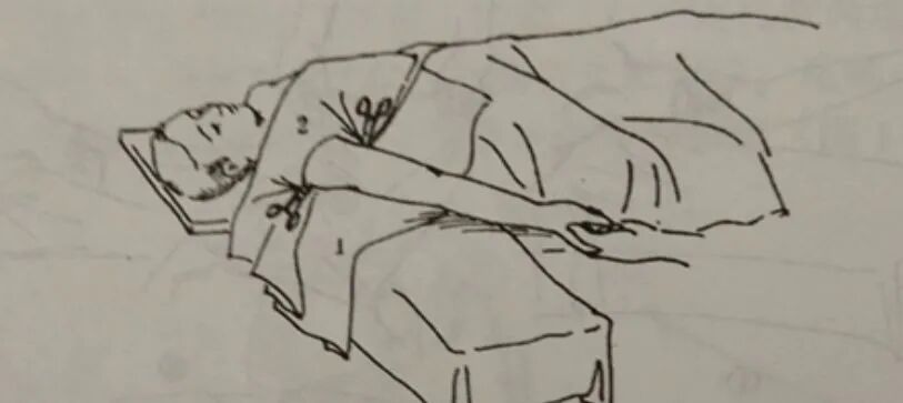 手术工具怎么消毒骨科手术消毒、铺巾操作，做好这几个细节事半功倍！_https://www.jmylbn.com_新闻资讯_第11张