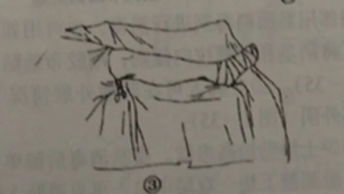 手术工具怎么消毒外科手术消毒、铺巾操作，做好这几个细节事半功倍！_https://www.jmylbn.com_新闻资讯_第22张