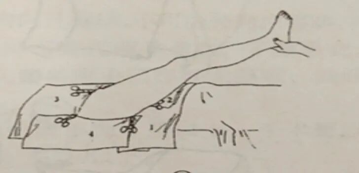 手术工具怎么消毒骨科手术消毒、铺巾操作，做好这几个细节事半功倍！_https://www.jmylbn.com_新闻资讯_第23张