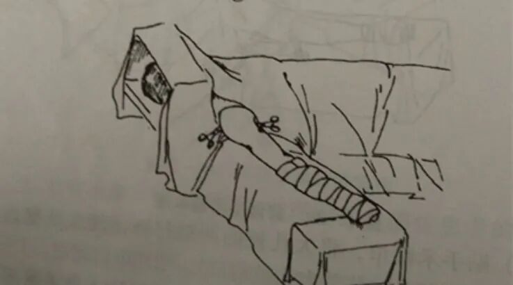 手术工具怎么消毒骨科手术消毒、铺巾操作，做好这几个细节事半功倍！_https://www.jmylbn.com_新闻资讯_第12张