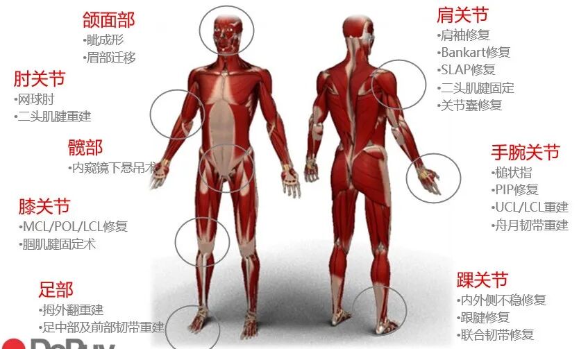 为什么用钢丝缝线骨科精读 ｜ 带线锚钉在骨科手术中的妙用，你掌握了几种？_https://www.jmylbn.com_新闻资讯_第2张