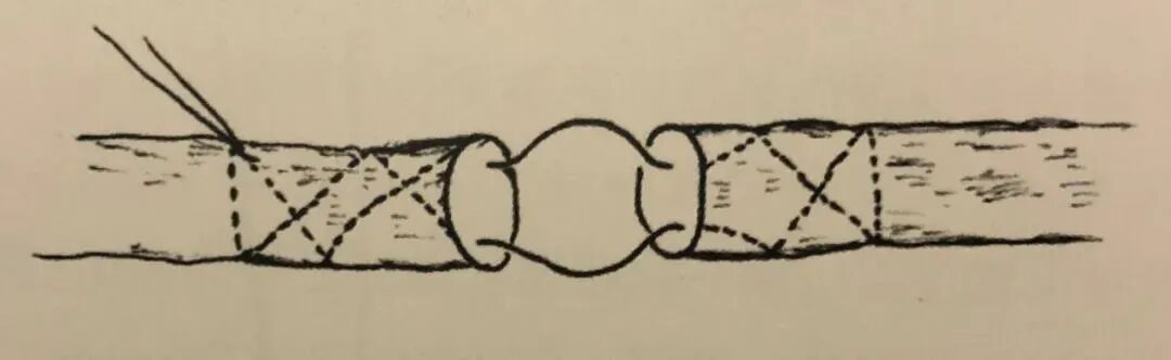 医疗缝线怎么做骨科精读 ｜ 如何做好手术缝合？这8种技术助你一臂之力！_https://www.jmylbn.com_新闻资讯_第22张