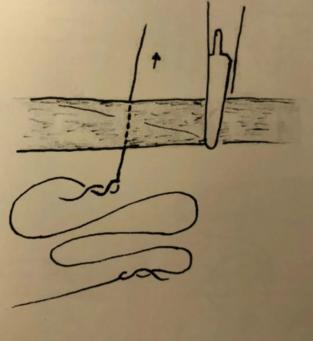 医疗缝线怎么做骨科精读 ｜ 如何做好手术缝合？这8种技术助你一臂之力！_https://www.jmylbn.com_新闻资讯_第19张