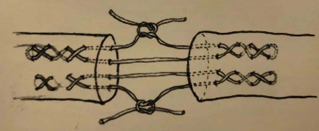 医疗缝线怎么做骨科精读 ｜ 如何做好手术缝合？这8种技术助你一臂之力！_https://www.jmylbn.com_新闻资讯_第29张