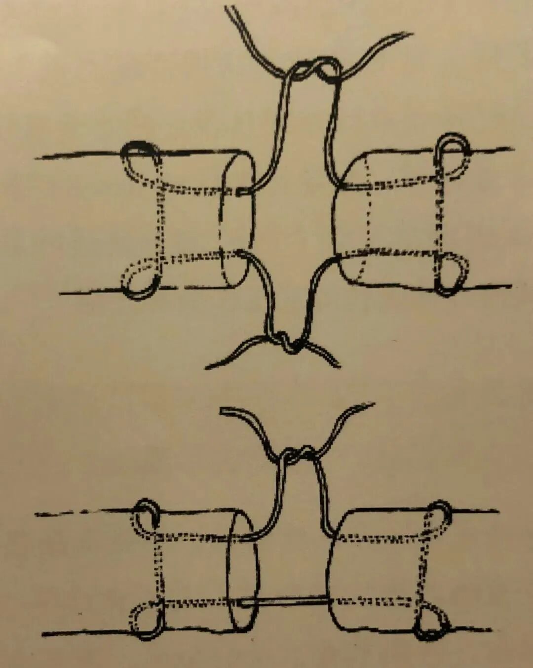 医疗缝线怎么做骨科精读 ｜ 如何做好手术缝合？这8种技术助你一臂之力！_https://www.jmylbn.com_新闻资讯_第17张