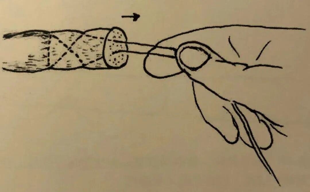 医疗缝线怎么做骨科精读 ｜ 如何做好手术缝合？这8种技术助你一臂之力！_https://www.jmylbn.com_新闻资讯_第21张