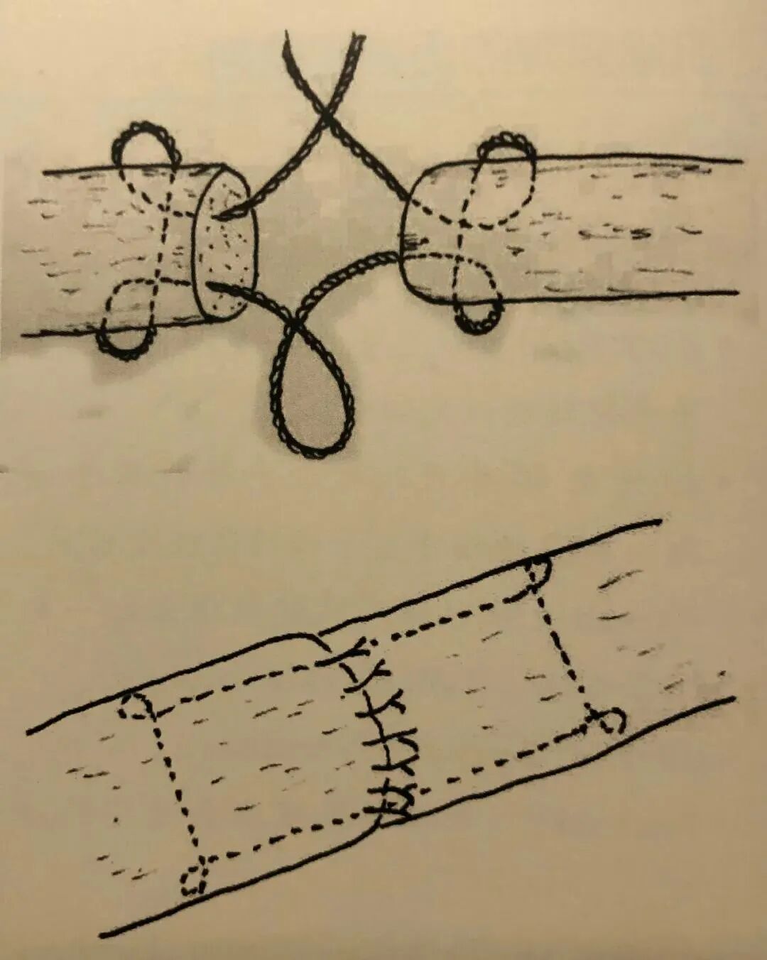 医疗缝线怎么做骨科精读 ｜ 如何做好手术缝合？这8种技术助你一臂之力！_https://www.jmylbn.com_新闻资讯_第18张