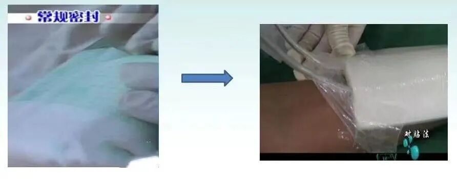 为什么负压引流骨科精读 ｜ 骨科常用的负压封闭引流术，一文读懂！_https://www.jmylbn.com_新闻资讯_第6张