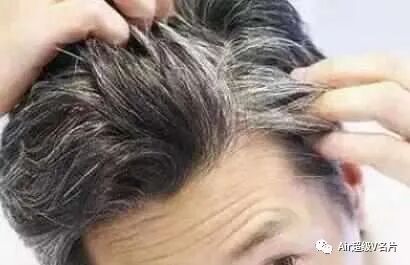 古法经络|看白发位置调五脏！