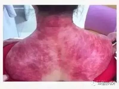 古法经络|为什么肩颈堵塞，可引发130多种疾病呢？