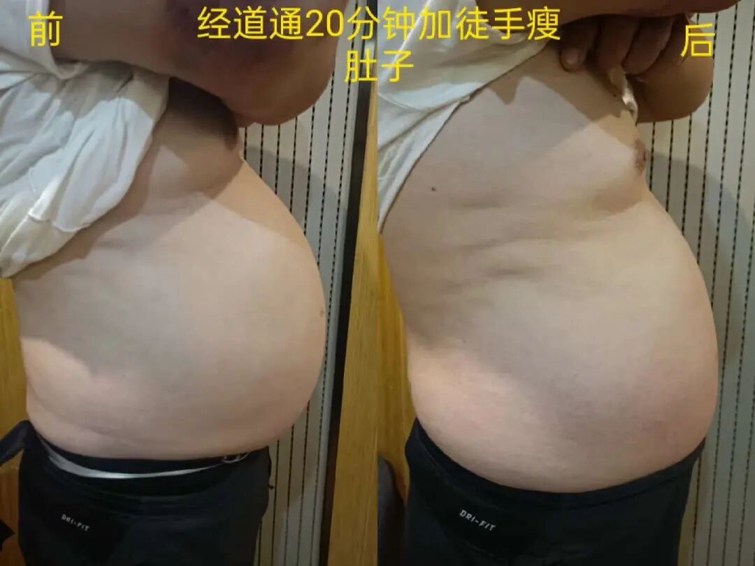 经络堵在哪里，多余的肉就长在哪里！