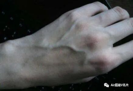 古法经络|青筋是人体的积滞，自查你哪里有青筋