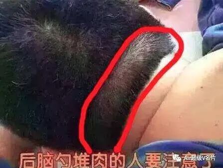古法经络|后脑勺“有堆肉”的人要注意了，一定要看！