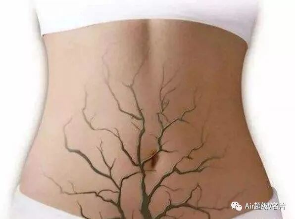 古法经络|影响女性一生健康的三个脏器和三个堵塞点