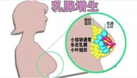 古法经络|“乳腺增生”看痧点儿辨轻重！