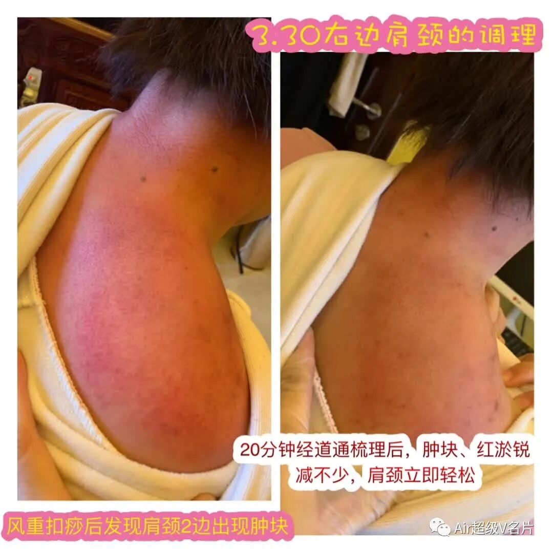 古法经络|肩颈疏通不能等，等堵了再通就晚了！