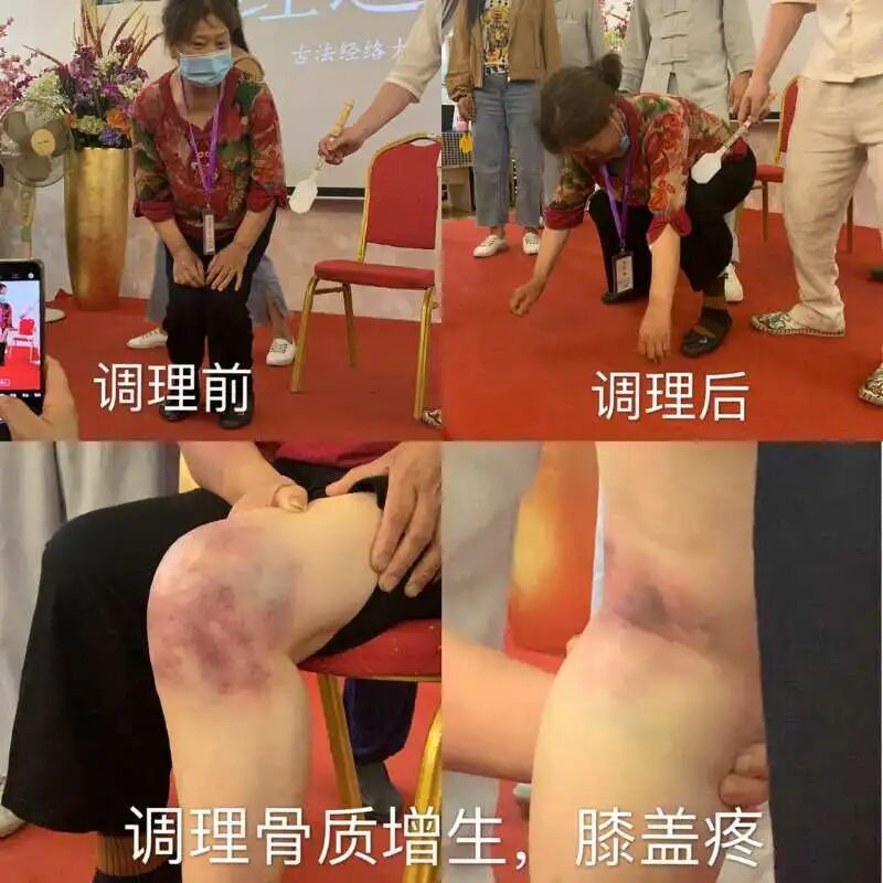 腿，是寒气大本营！如何驱寒？一步到位