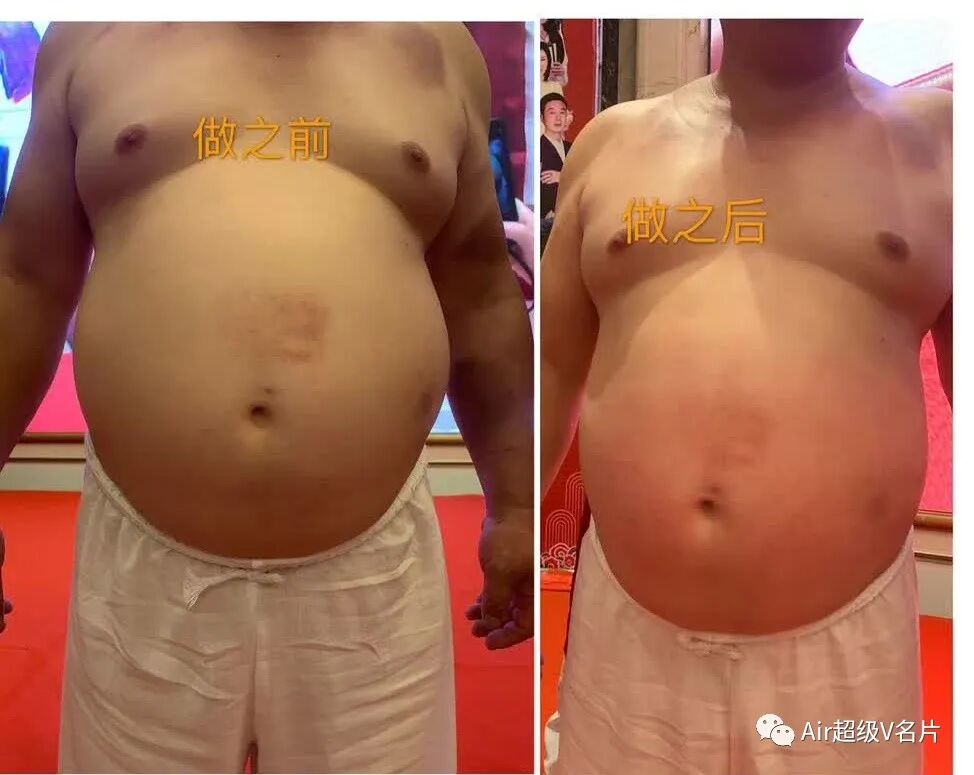 古法经络|作为一种简单易学的养生减肥方法，也许更适合你！