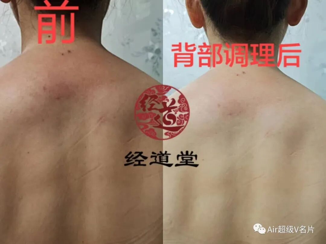 冬天排寒，关键在后背！