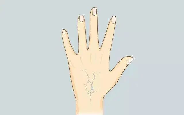 古法经络|身上有青筋？经络多调理