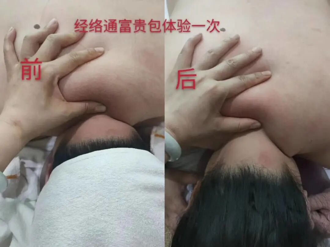 古法经络|它叫富贵包，不富贵，而且很要命！