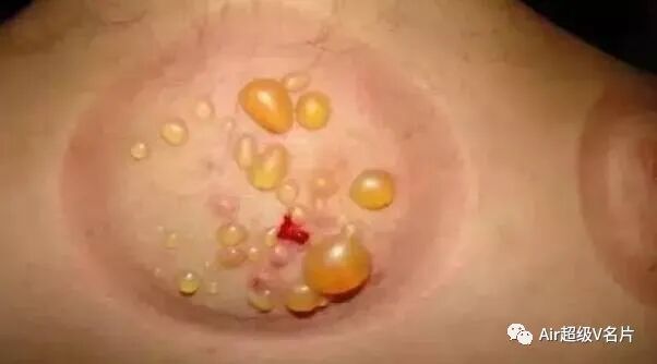 古法经络|病由“寒湿”起，人体达到“五级寒湿”命在旦夕！