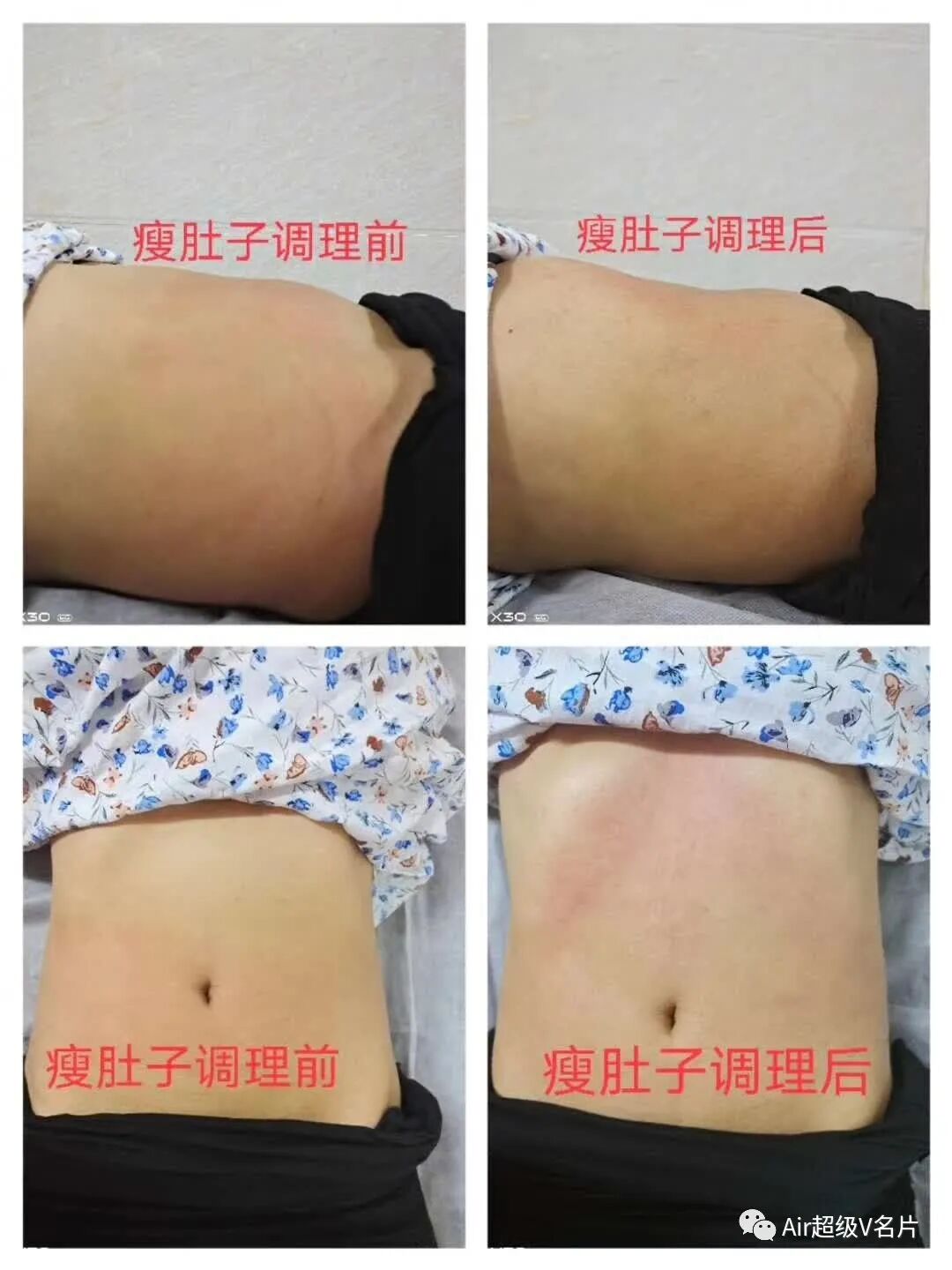 经络减肥不伤身，敲敲打打灭赘肉！