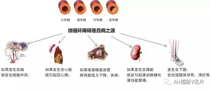 古法经络|经络堵塞，最容易造成衰老和死亡？