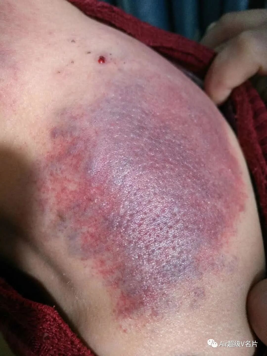 古法经络|身体不好，不是先补，而是先排湿毒