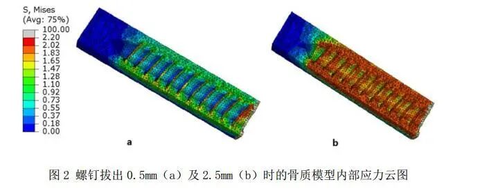 如何利用 HyperMesh 软件，对椎弓根钉轴向拔出的过程进行模拟的图6