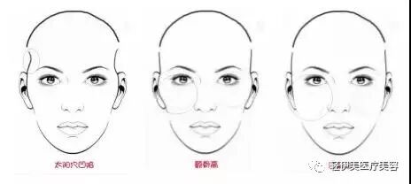 苹果肌还是颧骨高?这样的面相显老10岁不止!
