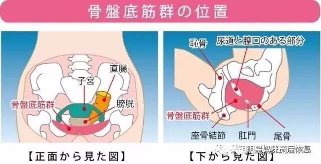【骨盆修复】那些不做骨盆修复的新妈妈，后来都怎么样了？