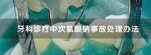 口腔冲洗液怎么喷牙科临床根管冲洗液次氯酸钠使用心得_https://www.jmylbn.com_新闻资讯_第6张